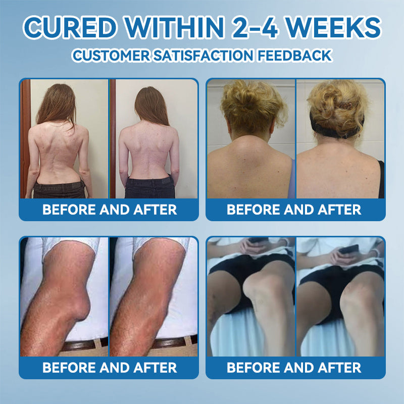 | 𝐋𝐚𝐬𝐭 𝐃𝐚𝐲 𝐏𝐫𝐨𝐦𝐨𝐭𝐢𝐨𝐧 𝟖𝟎% 𝐎𝐅𝐅 | 🇨🇦 Croaie® BPC-157 Joint Healing Cream🦴Treats Arthritis, Neuropathy, Rheumatism, Sports Injuries & More🌸
