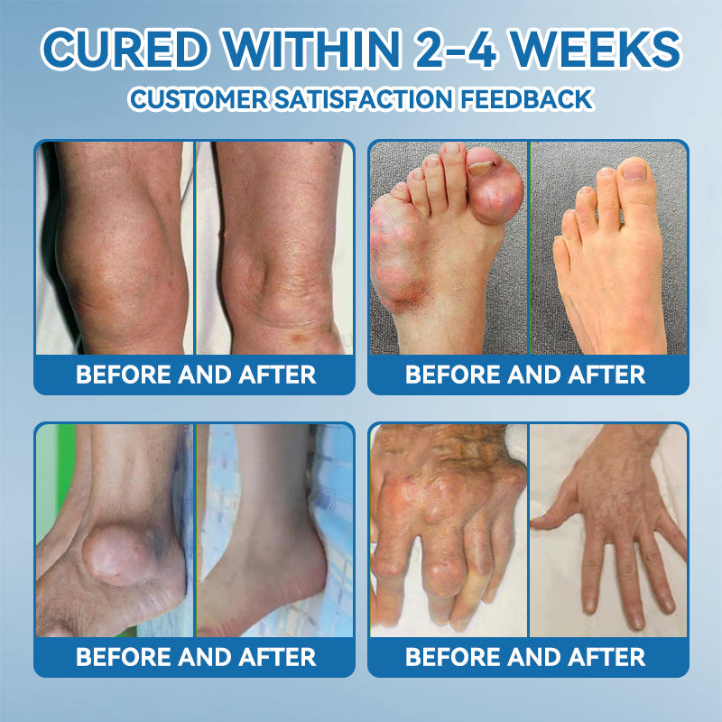 | 𝐋𝐚𝐬𝐭 𝐃𝐚𝐲 𝐏𝐫𝐨𝐦𝐨𝐭𝐢𝐨𝐧 𝟖𝟎% 𝐎𝐅𝐅 | 🇨🇦 Croaie® BPC-157 Joint Healing Cream🦴Treats Arthritis, Neuropathy, Rheumatism, Sports Injuries & More🌸