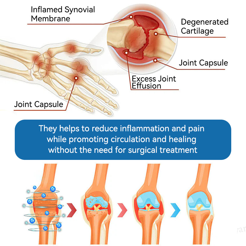 | 𝐋𝐚𝐬𝐭 𝐃𝐚𝐲 𝐏𝐫𝐨𝐦𝐨𝐭𝐢𝐨𝐧 𝟖𝟎% 𝐎𝐅𝐅 | 🇨🇦 Croaie® BPC-157 Joint Healing Cream🦴Treats Arthritis, Neuropathy, Rheumatism, Sports Injuries & More🌸