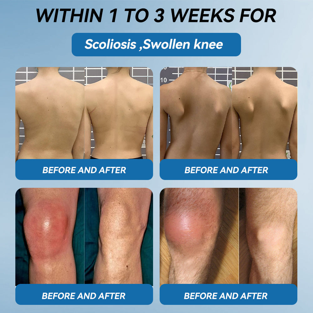 | 𝐋𝐚𝐬𝐭 𝐃𝐚𝐲 𝐏𝐫𝐨𝐦𝐨𝐭𝐢𝐨𝐧 𝟖𝟎% 𝐎𝐅𝐅 | 🇨🇦 Croaie® BPC-157 Joint Healing Cream🦴Treats Arthritis, Neuropathy, Rheumatism, Sports Injuries & More🌸