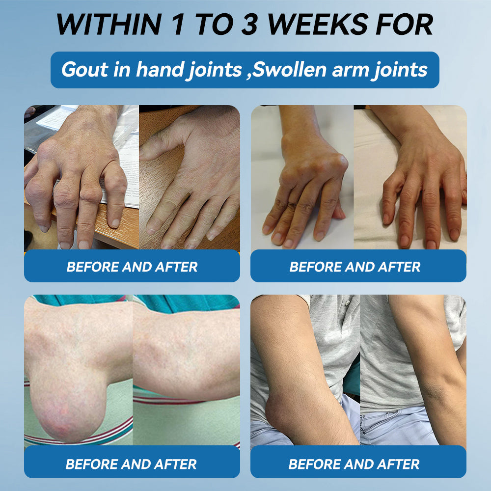 | 𝐋𝐚𝐬𝐭 𝐃𝐚𝐲 𝐏𝐫𝐨𝐦𝐨𝐭𝐢𝐨𝐧 𝟖𝟎% 𝐎𝐅𝐅 | 🇨🇦 Croaie® BPC-157 Joint Healing Cream🦴Treats Arthritis, Neuropathy, Rheumatism, Sports Injuries & More🌸