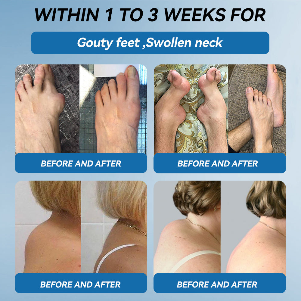 | 𝐋𝐚𝐬𝐭 𝐃𝐚𝐲 𝐏𝐫𝐨𝐦𝐨𝐭𝐢𝐨𝐧 𝟖𝟎% 𝐎𝐅𝐅 | 🇨🇦 Croaie® BPC-157 Joint Healing Cream🦴Treats Arthritis, Neuropathy, Rheumatism, Sports Injuries & More🌸