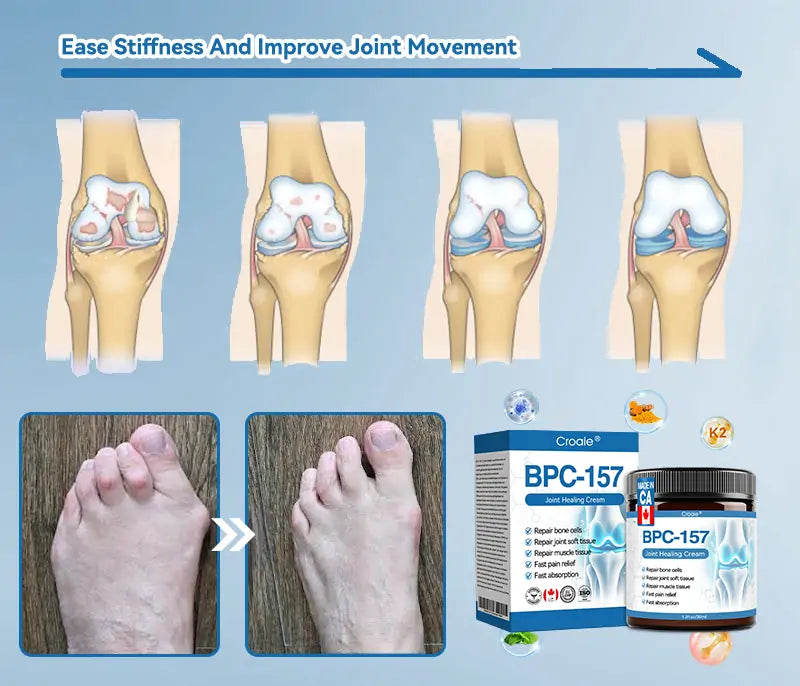 𝐂𝐫𝐨𝐚𝐢𝐞® BPC-157 Joint Healing Cream 🦴 Fast-Acting Relief for Canadians – Arthritis, Rheumatism & More | Limited Time 80% OFF
