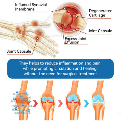 | 𝐋𝐚𝐬𝐭 𝐃𝐚𝐲 𝐏𝐫𝐨𝐦𝐨𝐭𝐢𝐨𝐧 𝟖𝟎% 𝐎𝐅𝐅 |  🇨🇦 Croaie® BPC-157 Joint Healing Cream🦴Treats Arthritis, Neuropathy, Rheumatism, Sports Injuries & More🌸