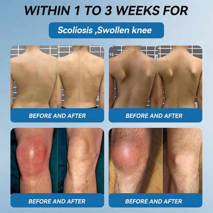 | 𝐋𝐚𝐬𝐭 𝐃𝐚𝐲 𝐏𝐫𝐨𝐦𝐨𝐭𝐢𝐨𝐧 𝟖𝟎% 𝐎𝐅𝐅 |  🇨🇦 Croaie® BPC-157 Joint Healing Cream🦴Treats Arthritis, Neuropathy, Rheumatism, Sports Injuries & More🌸